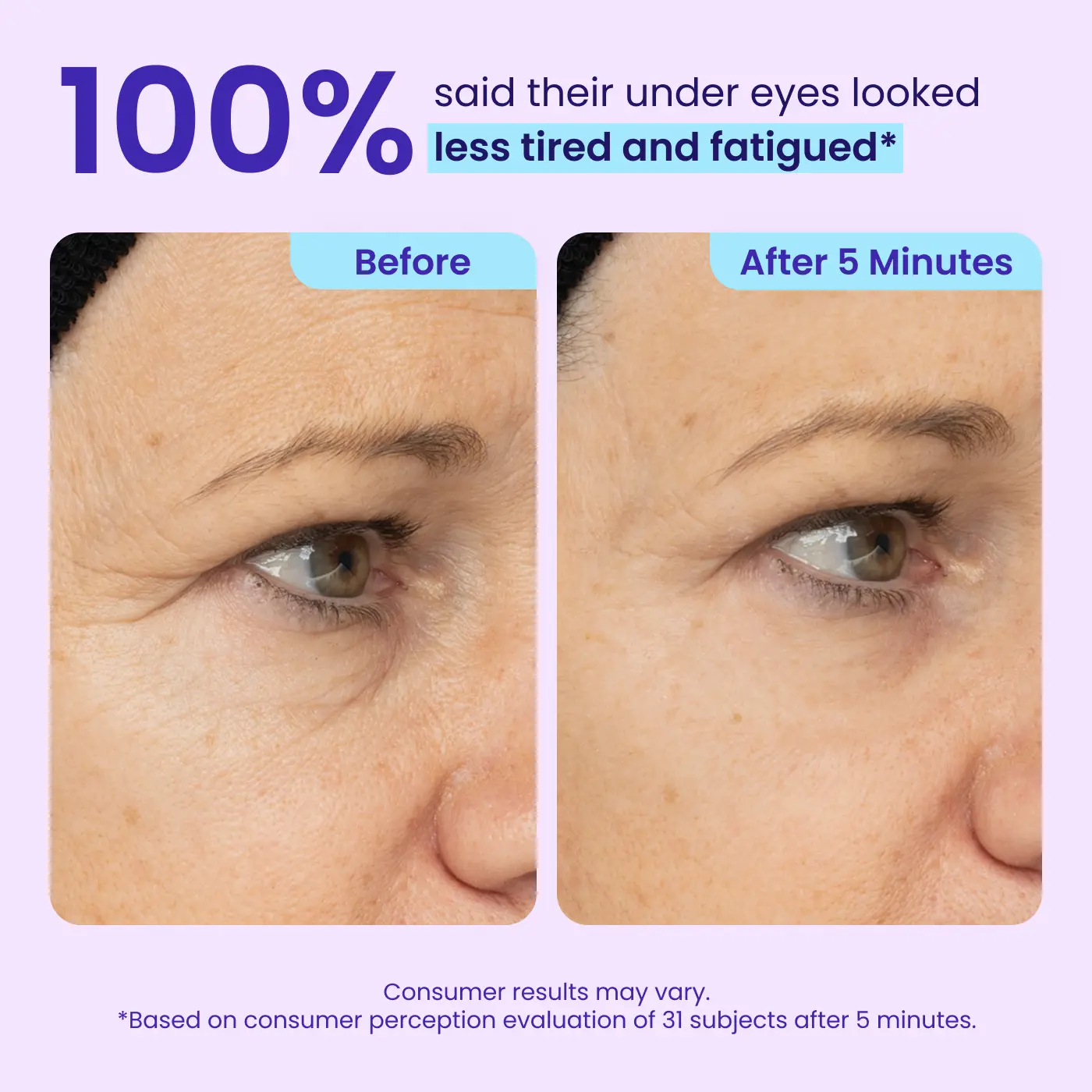 Letzte 3 Stunden: 70% RABATT🔥Augenringe in Minuten entfernen – WIMAID Augencreme: Sofort erfrischtes Aussehen
