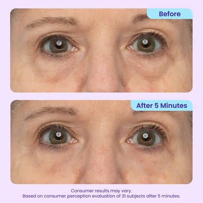 Letzte 3 Stunden: 70% RABATT🔥Augenringe in Minuten entfernen – WIMAID Augencreme: Sofort erfrischtes Aussehen