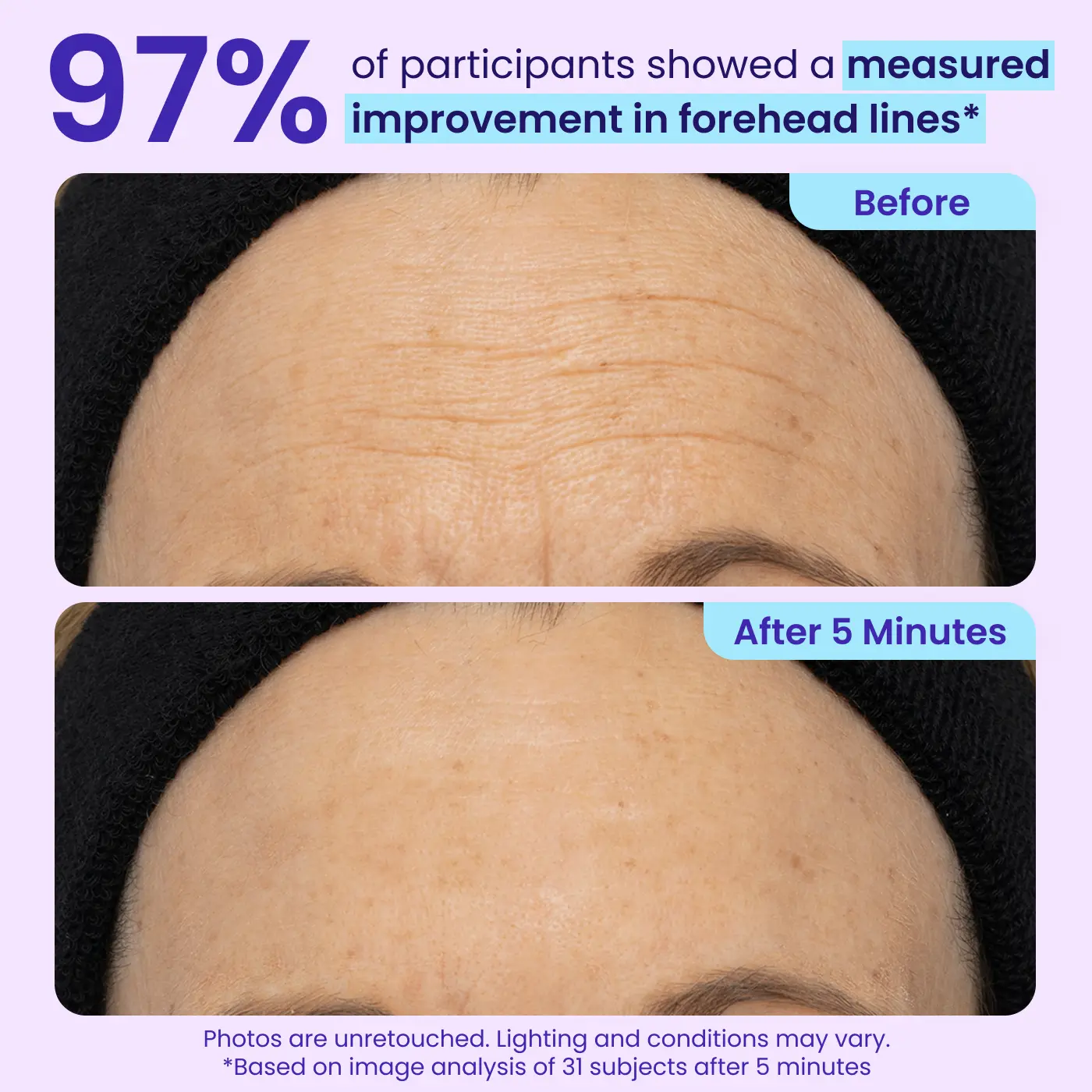 Letzte 3 Stunden: 70% RABATT🔥Augenringe in Minuten entfernen – WIMAID Augencreme: Sofort erfrischtes Aussehen