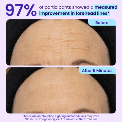 Letzte 3 Stunden: 70% RABATT🔥Augenringe in Minuten entfernen – WIMAID Augencreme: Sofort erfrischtes Aussehen